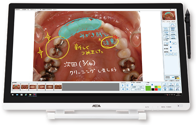 患者説明用ソフト